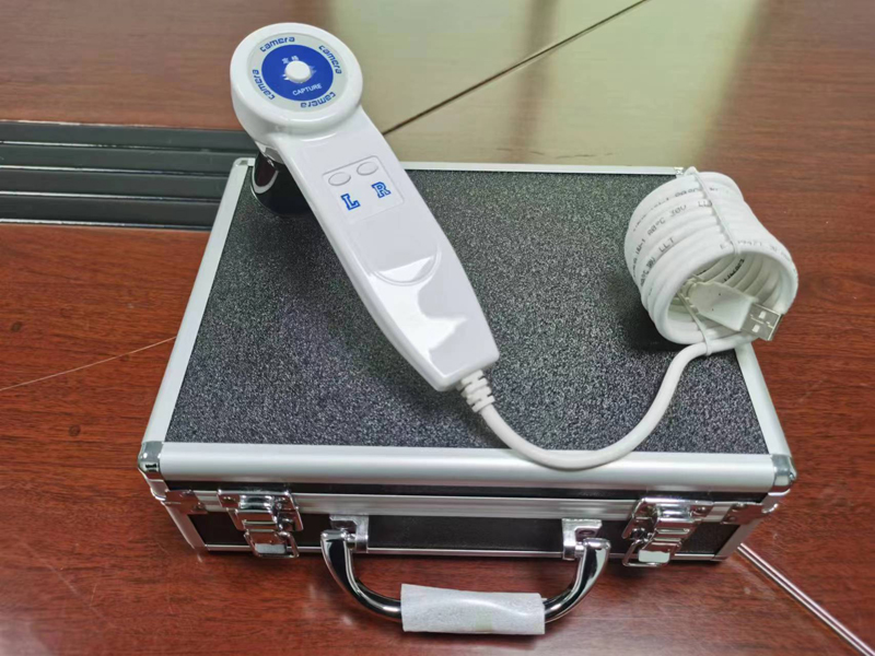 5,0-MP-Digital-Iridologie-Kame – Qh Furniture Bewertung und Preis